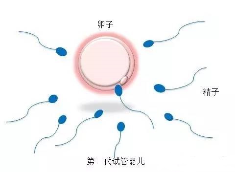医疗设备